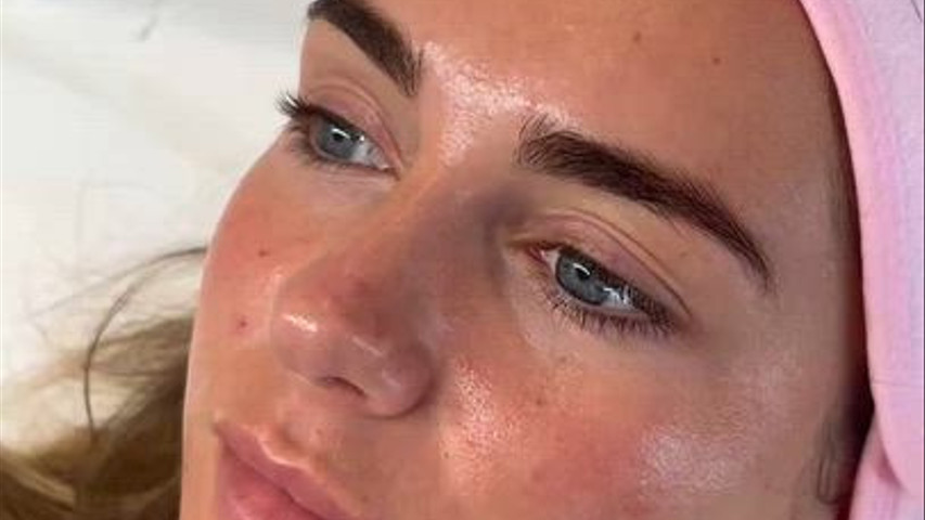 Facial
